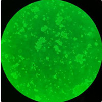 HTMC 人眼小梁网细质粒载体网